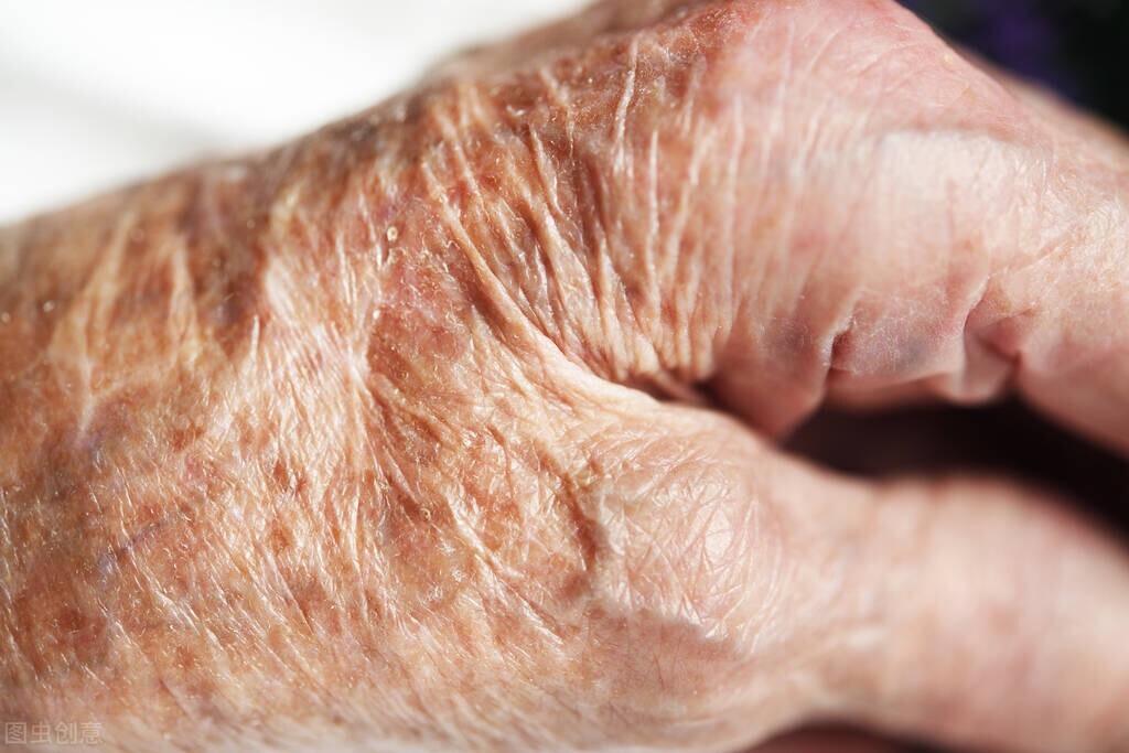 上了年纪后老人身上的“老人味”,可能是疾病先兆