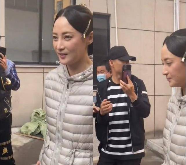 面部衰老皱纹解剖图,面部皱纹衰老对比图