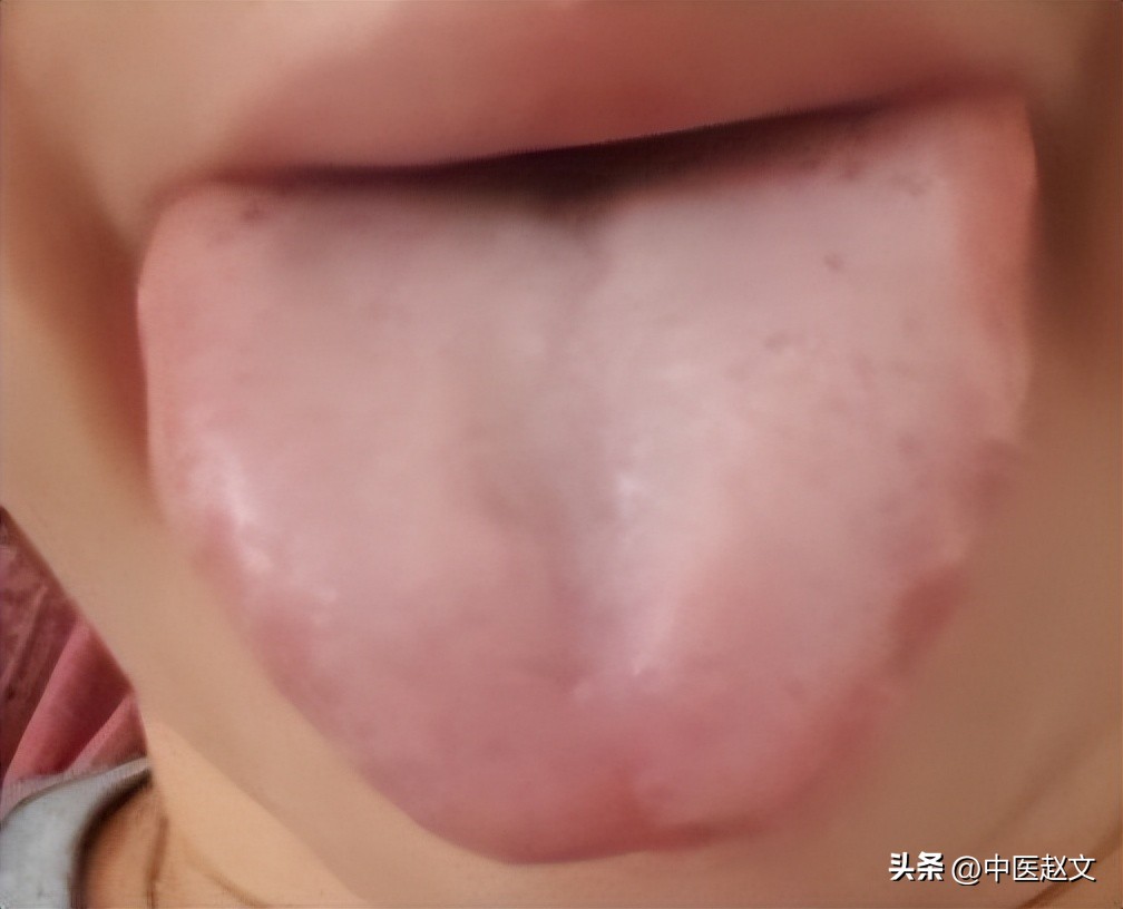 归脾丸治失眠多梦效果怎样,失眠多梦易醒归脾丸配什么好