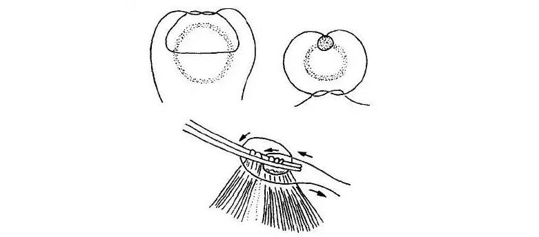 外科各种缝合方法的适用情况,外科操作缝合