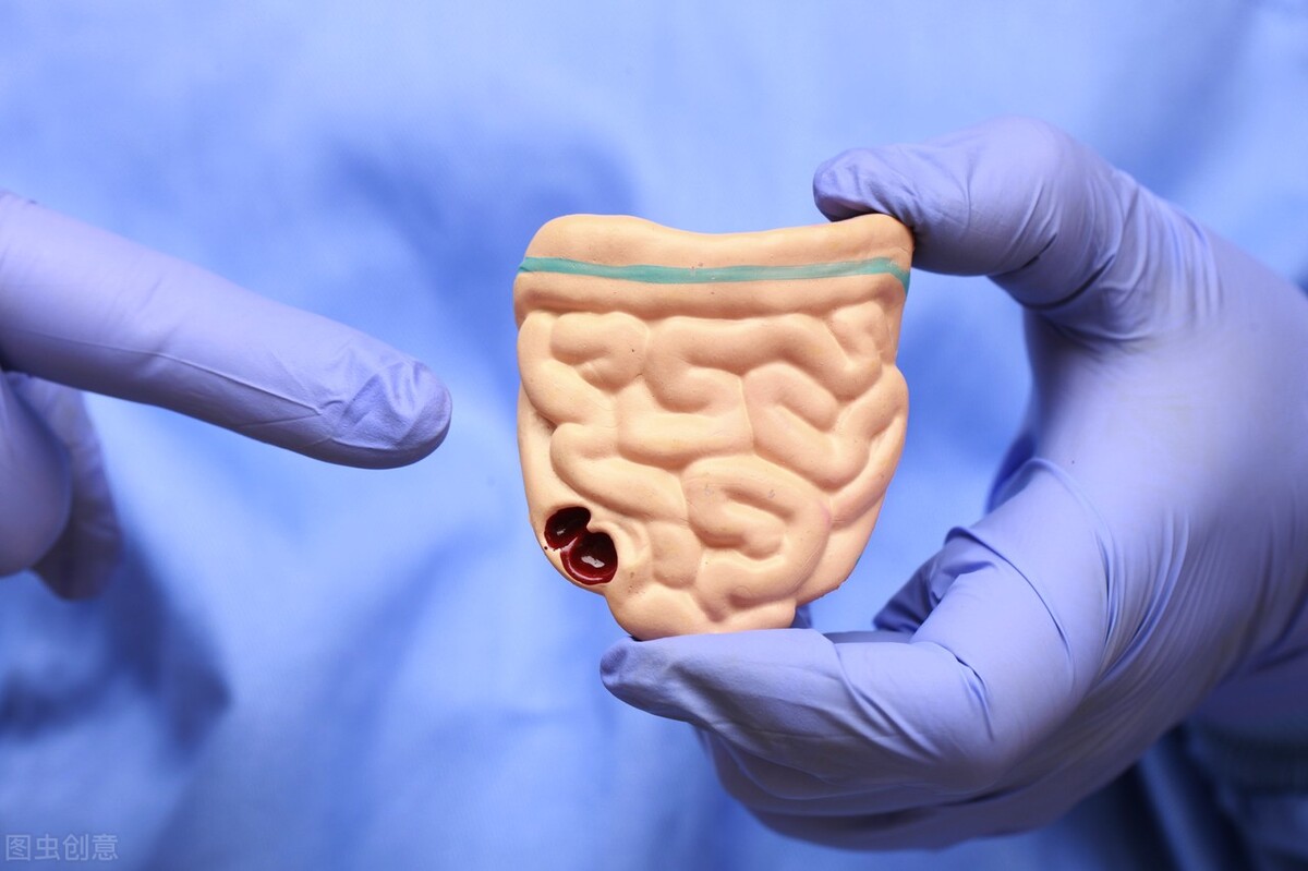 直肠癌转肝的早期症状,阿健说直肠癌早期症状