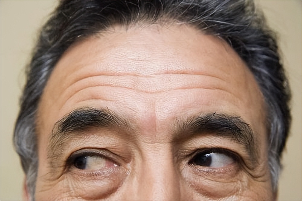 男人身上三处发黑证明肾功能很强,肾功能异常脸色发黑