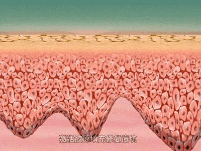 下巴反反复复有痘痘,脸上起痘痘反反复复