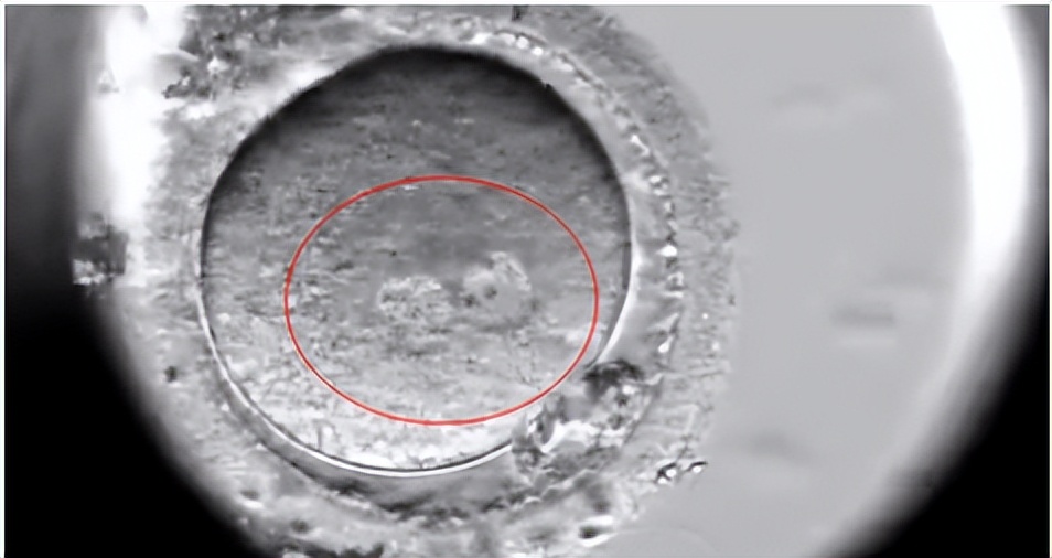 试管婴儿失败是流产吗,试管精子和卵子不能自然结合原因