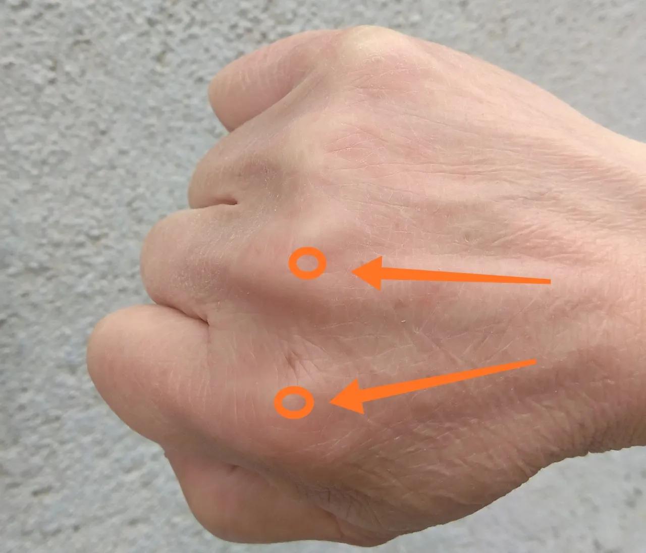 眼眶胀痛、上眼皮浮肿、双眼模糊，教你一招缓解