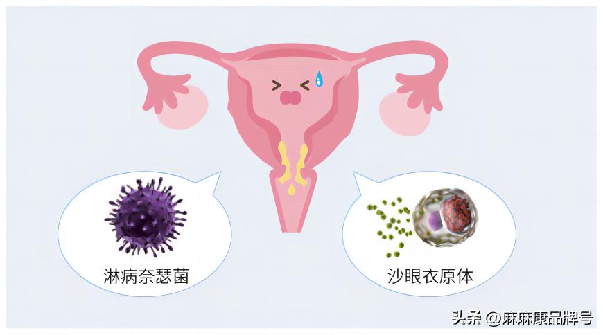 妇科宫颈炎怎么引起的,妇科宫颈炎是什么原因