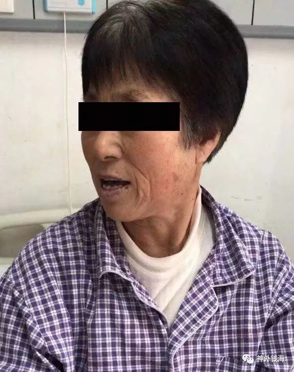 “歪脖子”是种病,需要手术治疗