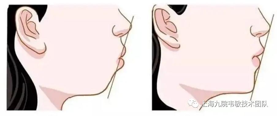 上海九院韦敏看胎记吗,九院韦敏案例