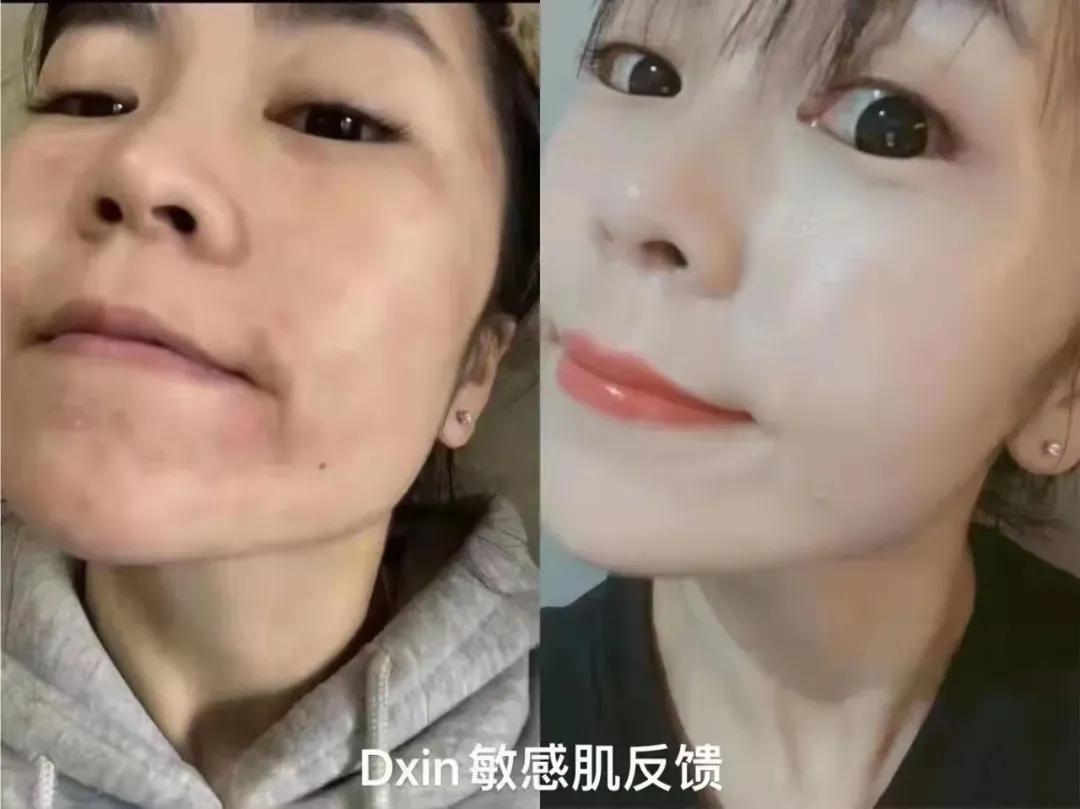 董欣护肤品哪个好用,董欣护肤品推荐