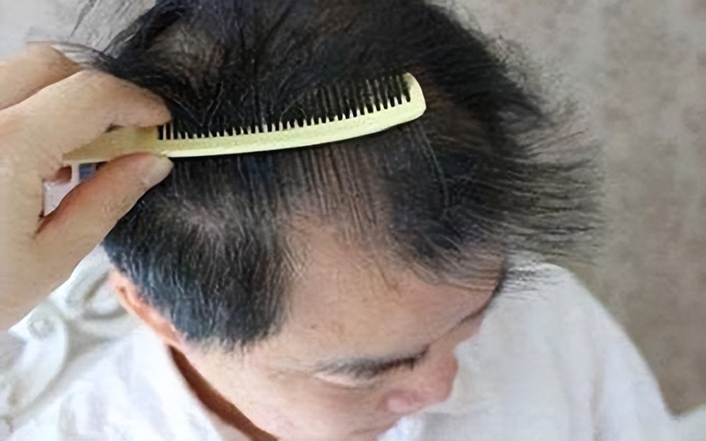 身体缺乏哪种维生素会导致白发,人体缺少什么营养素会造成白发