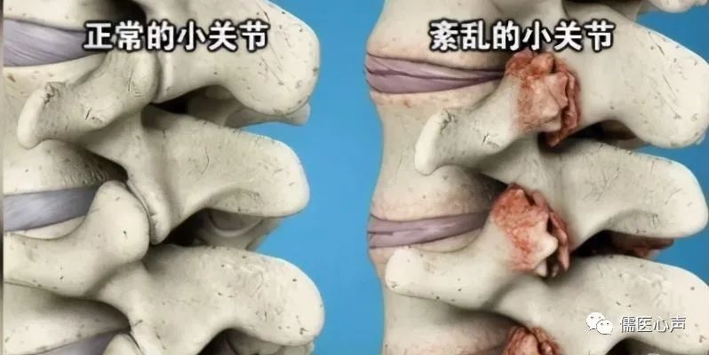 抢菜抢不到该怎么活,抢菜抢米啥都抢该怎么办