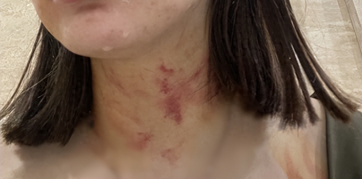 女子狗尾巴扫到对方被打后续,狗尾巴扫到别人被打女子抖音后续