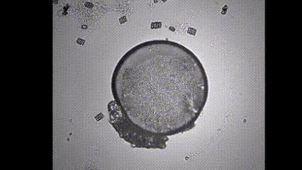 运动神经元显微镜观察内容与结果,显微镜下观察神经元的判断依据