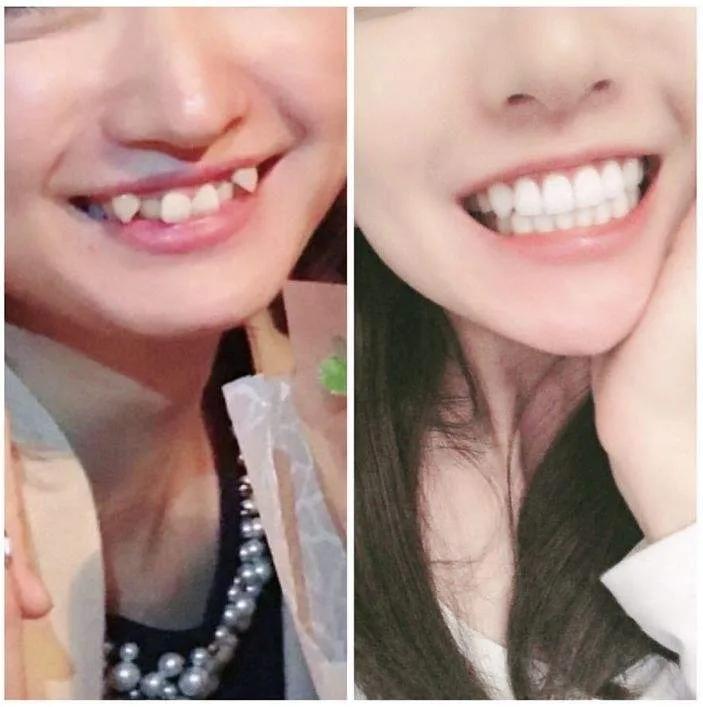 运动天赋好的特征图片,运动天赋一览表