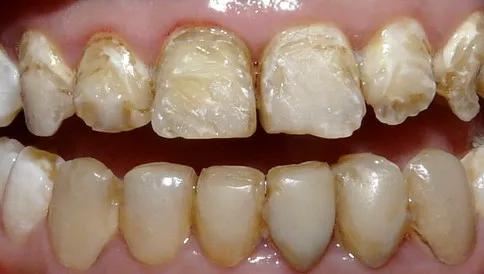 最顶级的三款抗生素,三种抗生素