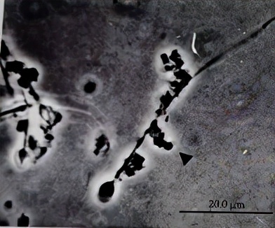 uu感染会自愈么,uu感染是hiv吗