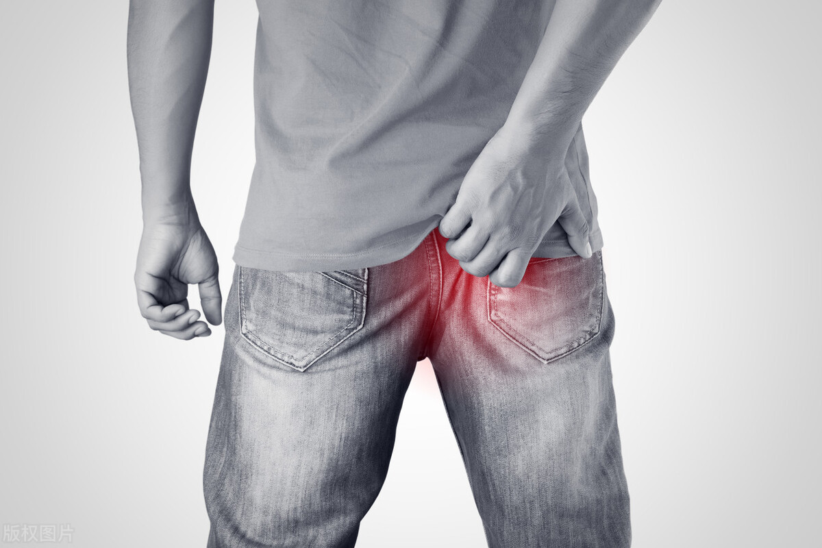 肛门两边潮湿瘙痒用什么药,夏季肛门附近潮湿瘙痒