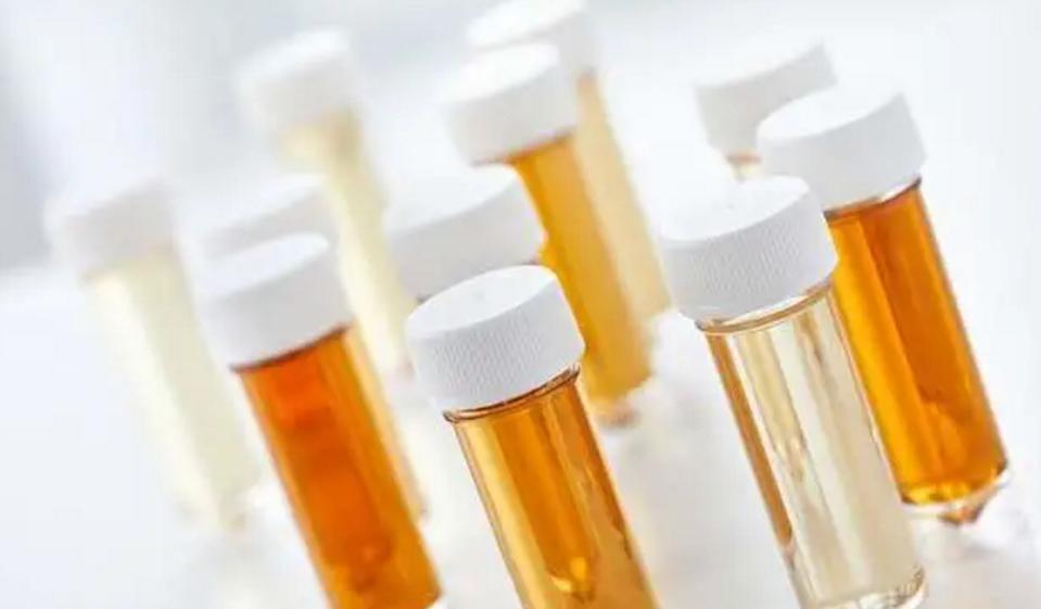 男性尿液有泡沫就是肾出了问题吗,小便有细小泡沫肾没问题怎么回事