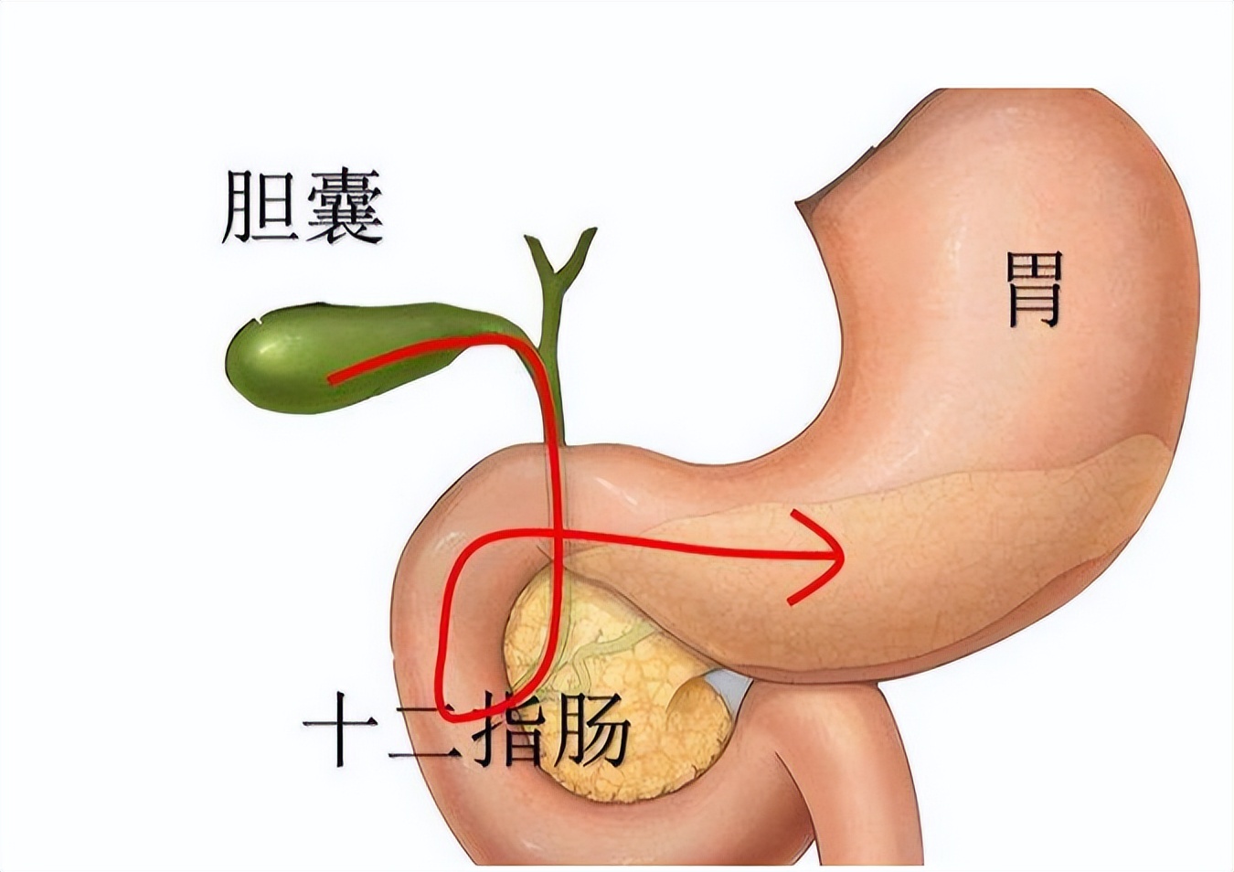 胆囊出现问题身体会出现哪些症状,人没了胆会有哪些症状