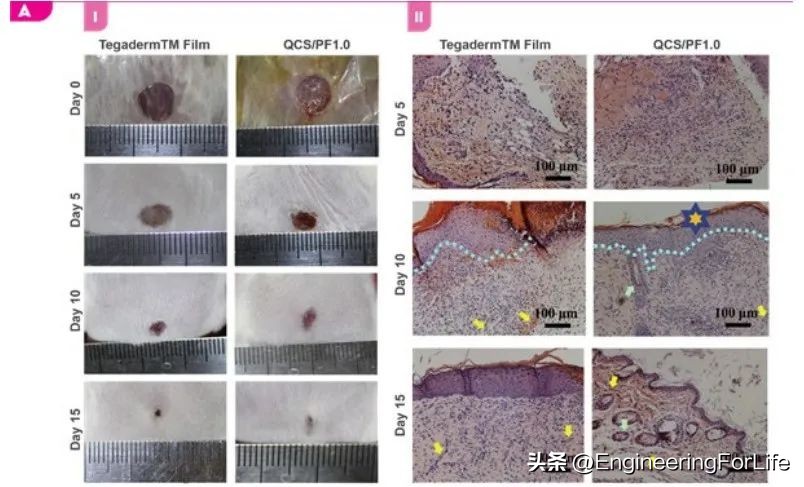《AM》综述：对具有抗菌性能生物粘合剂的深度剖析