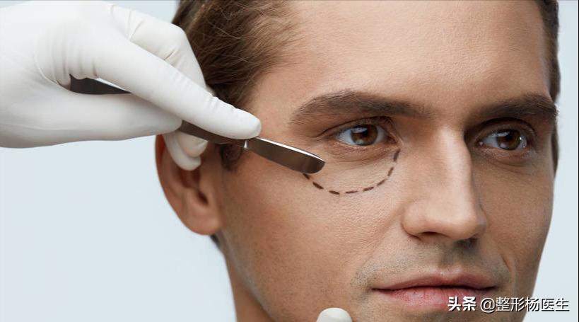 眼袋手术后真的显年轻吗,割眼袋能年轻几岁