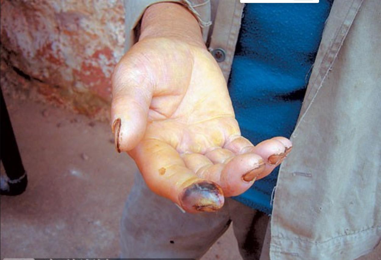 还敢随便杀蛇吗？被砍下的蛇头还能咬人，难道蛇死了还会*仇报**？