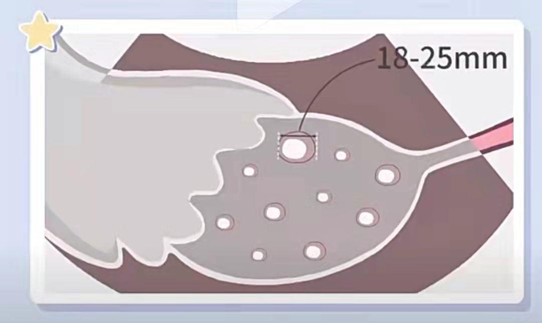 吃什么能生下聪明宝宝,吃什么能养卵子的质量