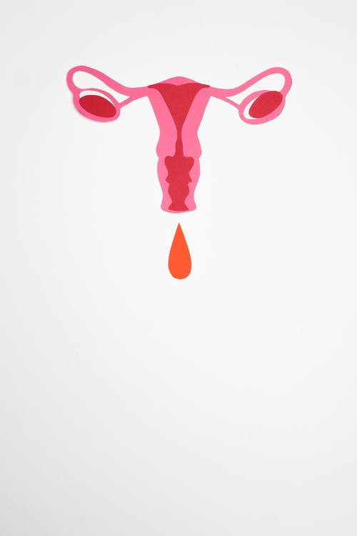 试管移植后出血是怎么回事,试管移植17天出血有成功的吗