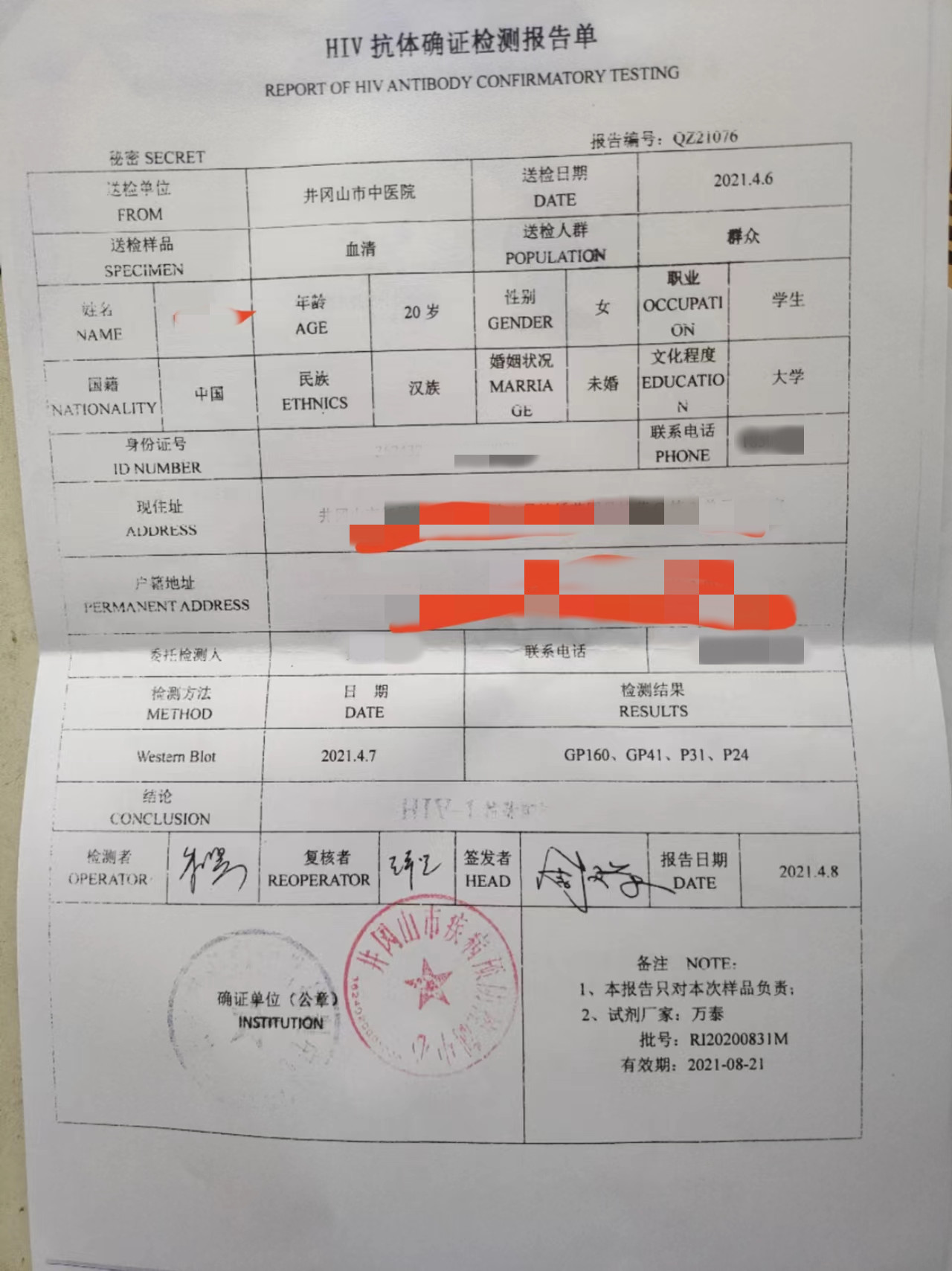 江西一女大学生感染艾滋病,江西19岁女孩艾滋病