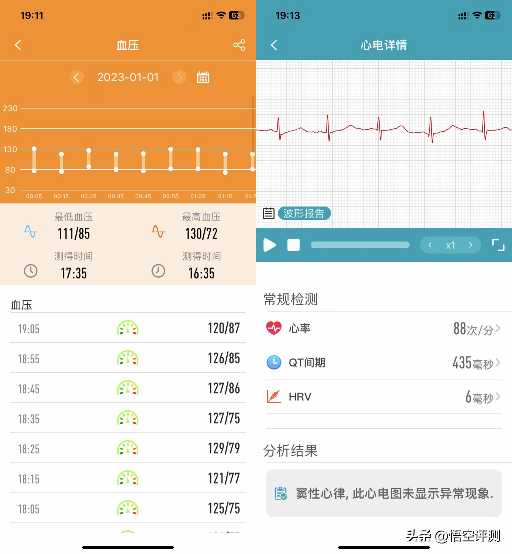 didoe55智能手表靠谱吗,智能手表健康管理哪个最有用