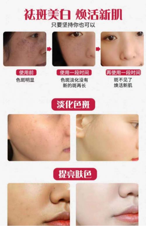冬季用淡斑的护肤品淡斑效果好吗,美白淡斑效果最好的护肤品排行榜