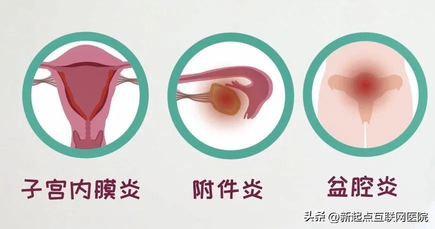 下体瘙痒发臭是什么原因怎么解决,夏天来了脚瘙痒