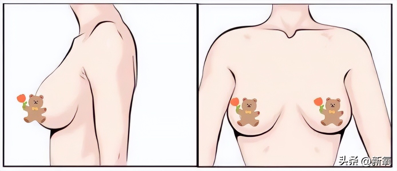 胸部略微下垂,胸部有时变大有时变小怎么回事