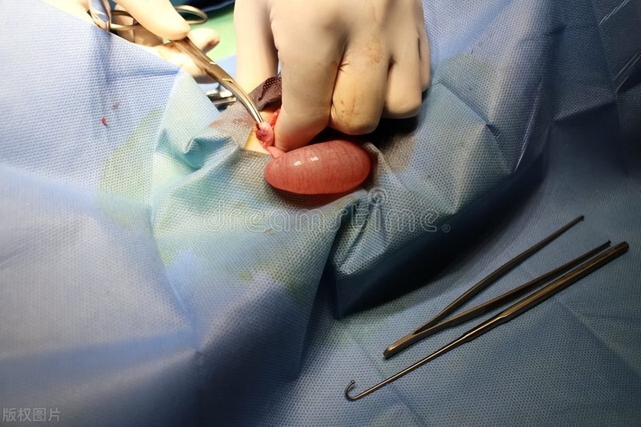 恶性囊肿与癌症的区别,与肿瘤相似的病