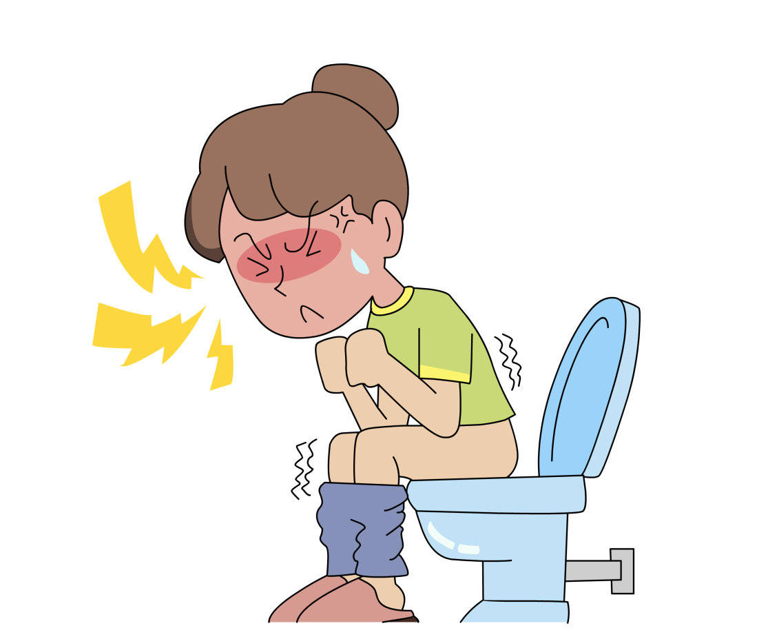 割痔疮大学生病例,二十多岁女生割痔疮