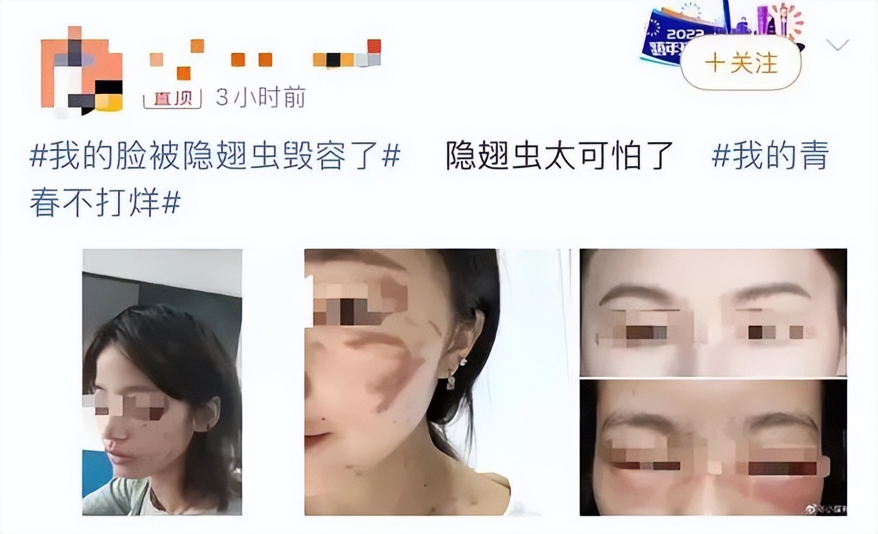 “我的脸被它毁容了…”毒液堪比硫酸！西安也有！