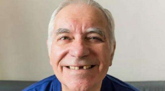 老年人一般多少岁才开始“掉牙”？牙齿脱落后，需要注意什么？