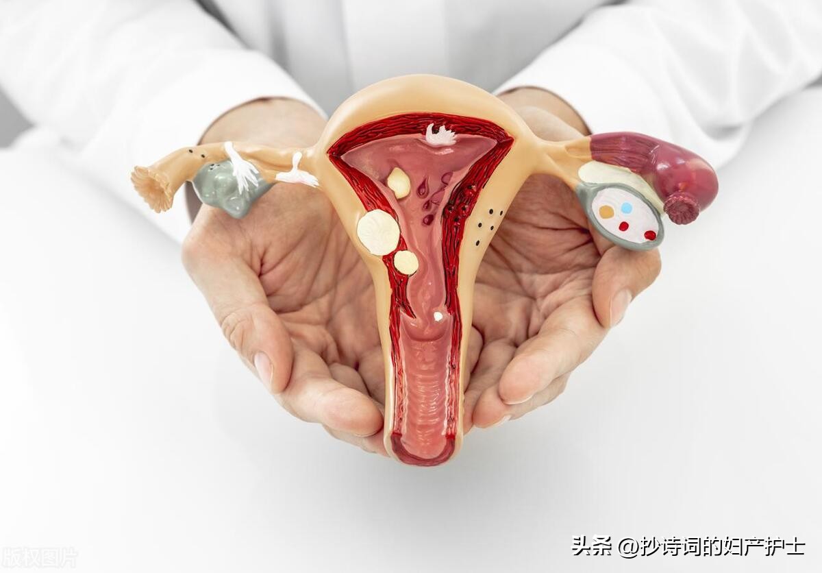 子宫内膜息肉，这个滋生出来的“小肉”，它会恶变吗