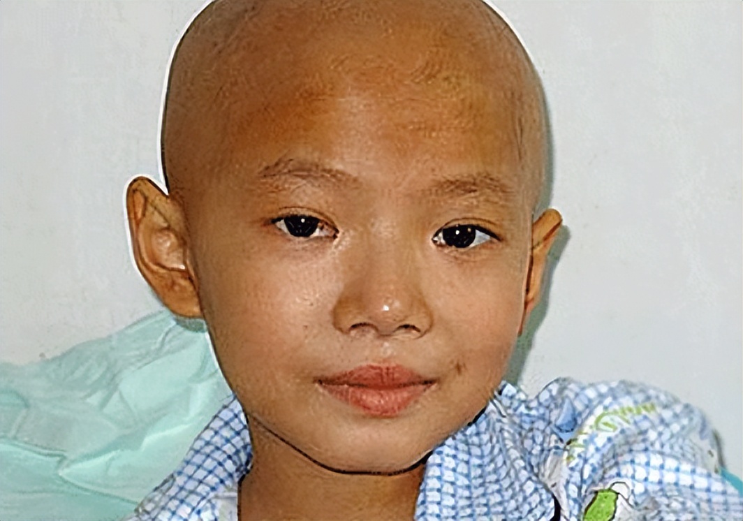 18岁患癌女孩临终遗言,女孩患癌18年一直坚持治愈成功