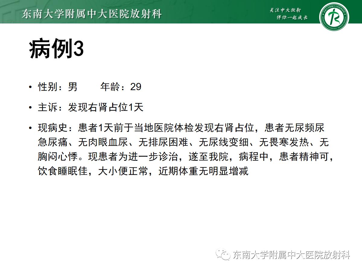 周利群谈肾嫌色细胞癌ct特点,好文分享值得深思