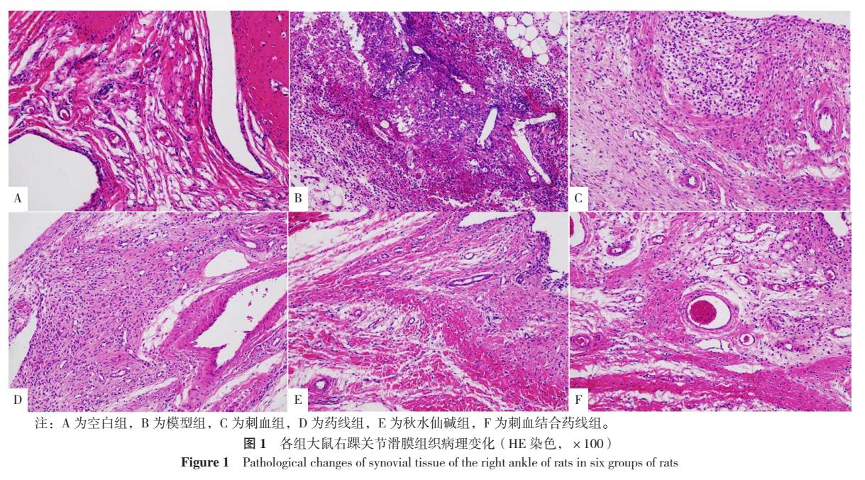刺血拔罐治痛风视频,刺血治痛风