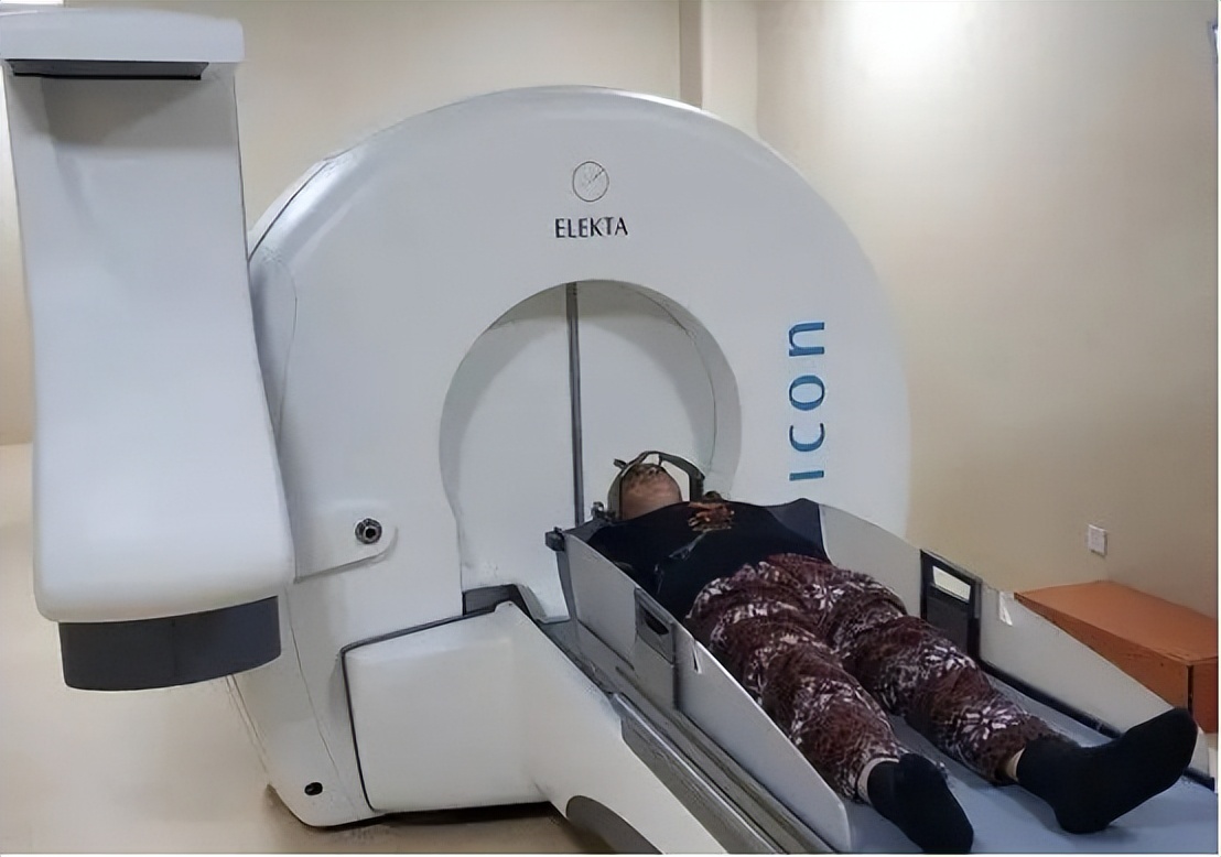 三叉神经痛伽玛刀可以维持多久,三叉神经痛伽玛刀有哪些副作用