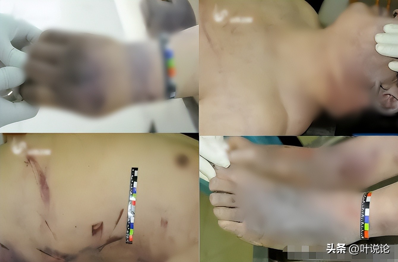 38岁丈夫因为欠下高额债务被打死,真实事件丈夫毒打妻子出门被杀