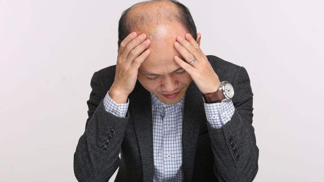 脱发为什么都是从头顶先秃,脱发为什么先从头顶脱