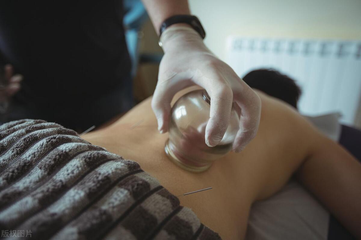 拔火罐的瘀血是身体内的毒素吗,拔火罐拔出的淤血是体内的毒素吗