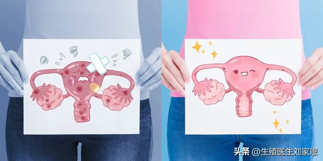 子宫内膜会跑到鼻腔里吗,子宫内膜增厚来例假排出大血块