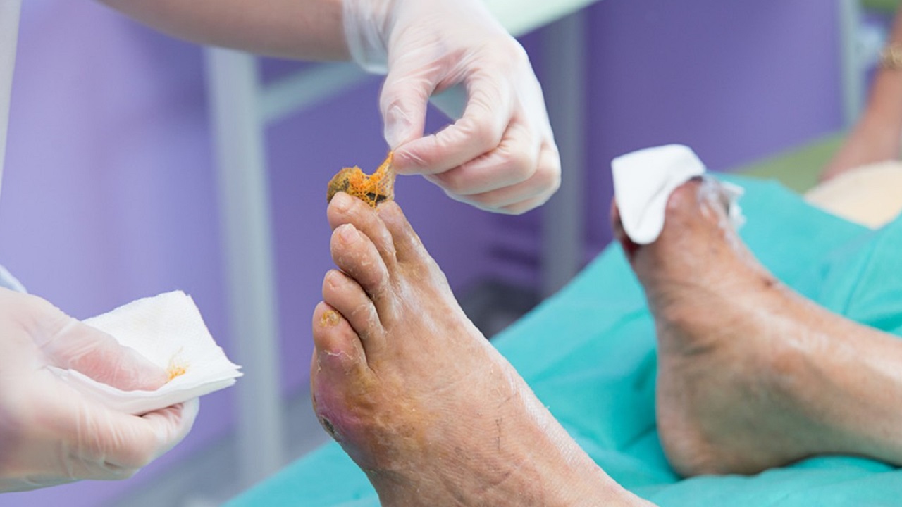 血糖偏高的人建议少吃这4种素食,55岁大叔因血糖过高死亡医生提醒