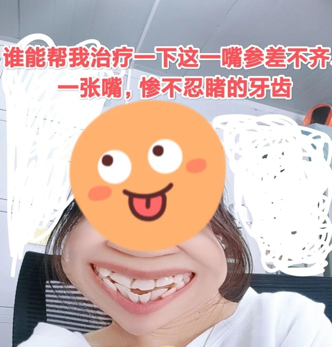 牙疼快速止疼,牙疼一般疼几天会自愈