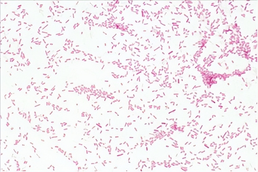 革兰氏染色如何鉴别细菌,微生物革兰氏染色方法步骤