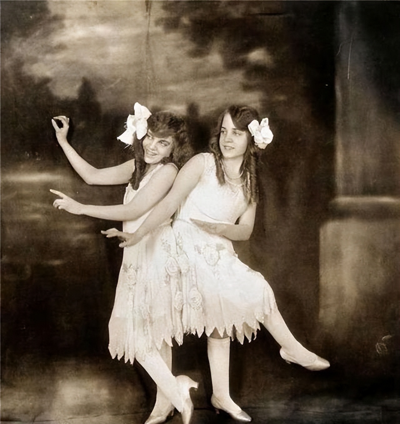 连体人一人去世了另一人会死吗,连体人死亡对另一半有影响吗